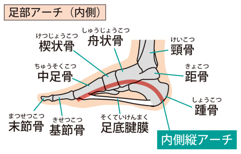 かかとの痛みの原因は足裏が硬いと起こる「足底腱膜炎」