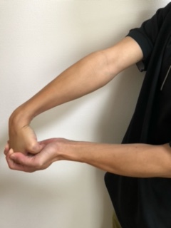 肘の外側の痛み。テニス肘の治療法と動作で気をつける事。